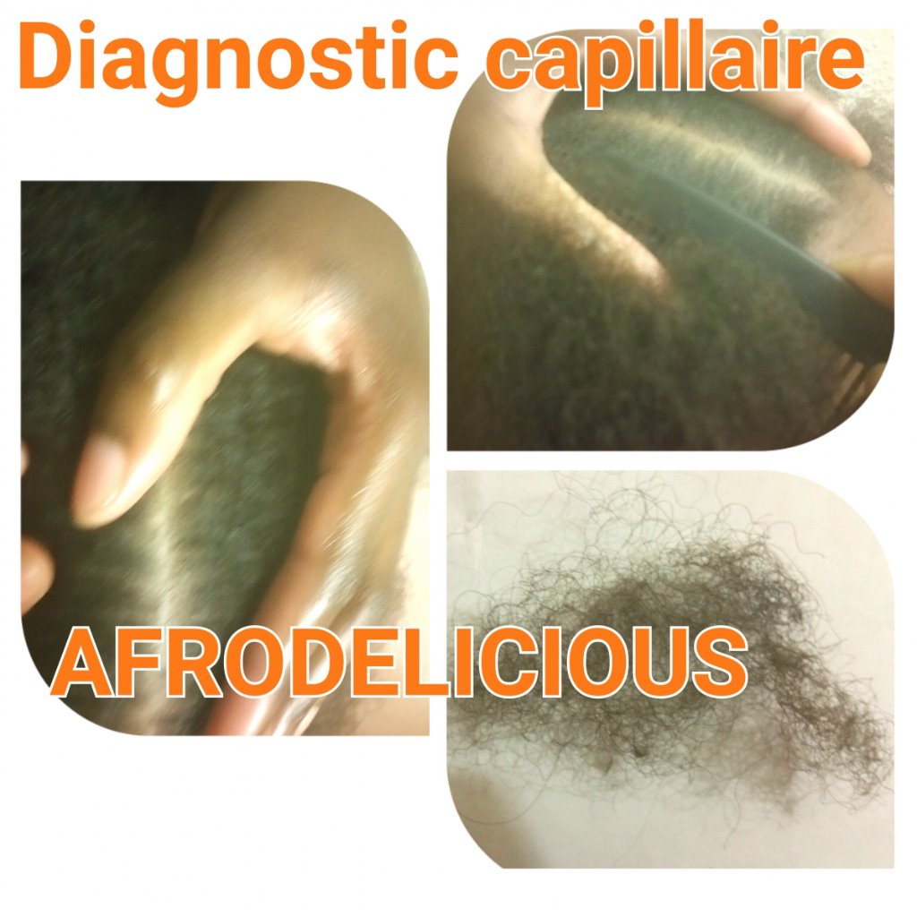 diagnostic capillaire avec appareil spécifique qui permet l'analyse du cheveu et du cuir chevelu